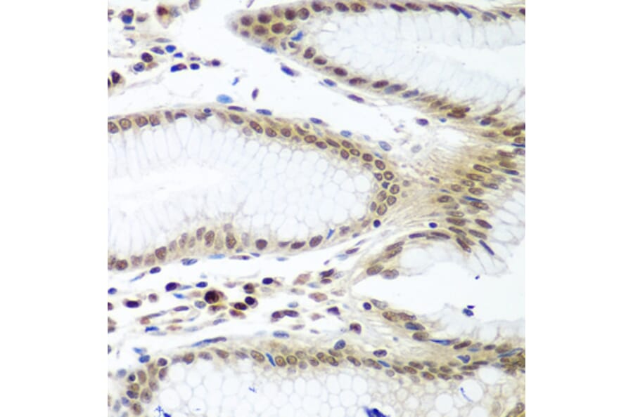 Immunohistochemistry - Anti-Securin Antibody (A16151) - Antibodies.com