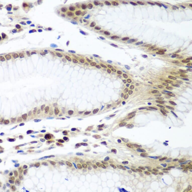 Immunohistochemistry - Anti-Securin Antibody (A16151) - Antibodies.com