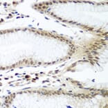 Immunohistochemistry - Anti-Securin Antibody (A16151) - Antibodies.com