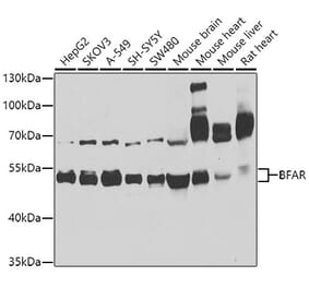 Western Blot - Anti-BFAR Antibody (A16152) - Antibodies.com