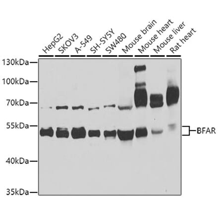 Western Blot - Anti-BFAR Antibody (A16152) - Antibodies.com