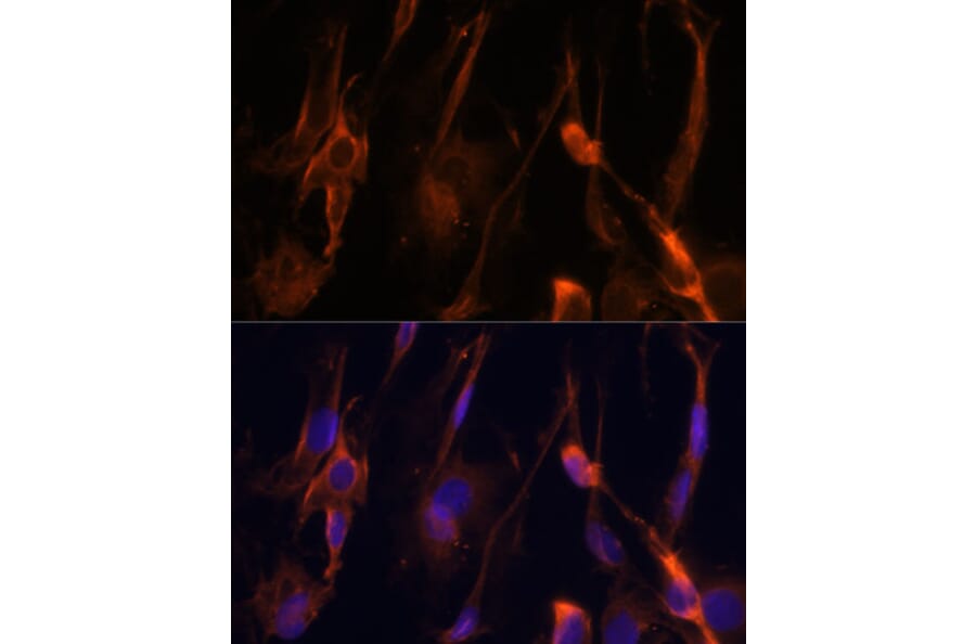Immunofluorescence - Anti-BFAR Antibody (A16152) - Antibodies.com