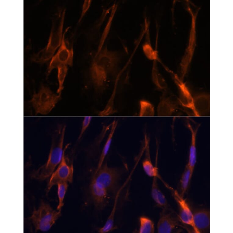 Immunofluorescence - Anti-BFAR Antibody (A16152) - Antibodies.com