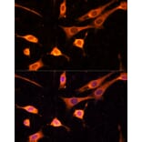 Immunofluorescence - Anti-BFAR Antibody (A16152) - Antibodies.com