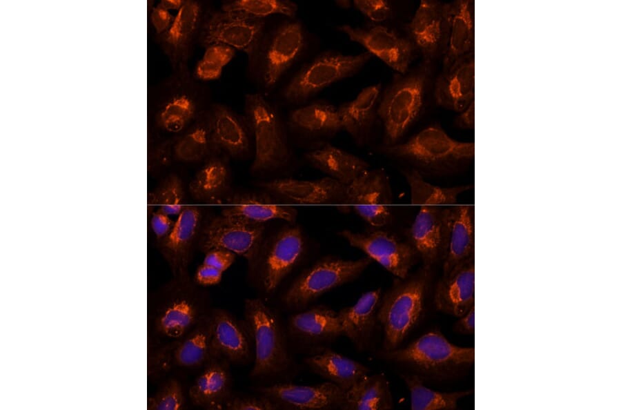 Immunofluorescence - Anti-BFAR Antibody (A16152) - Antibodies.com