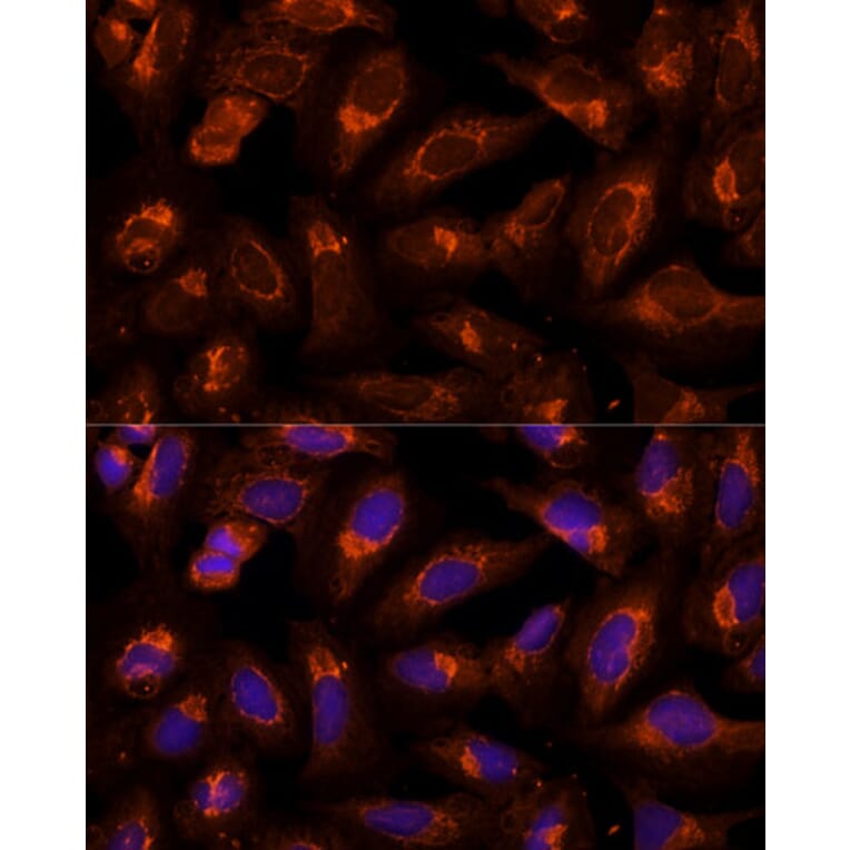 Immunofluorescence - Anti-BFAR Antibody (A16152) - Antibodies.com
