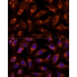 Immunofluorescence - Anti-BFAR Antibody (A16152) - Antibodies.com