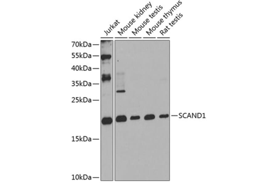 Western Blot - Anti-SCAND1 Antibody (A16153) - Antibodies.com
