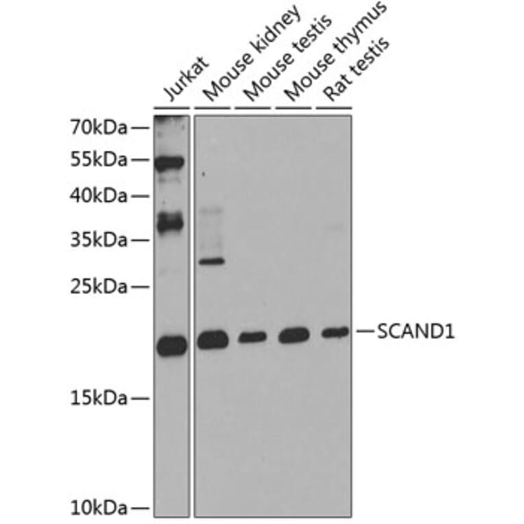 Western Blot - Anti-SCAND1 Antibody (A16153) - Antibodies.com