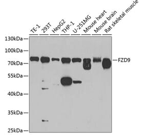 Western Blot - Anti-Frizzled 9 Antibody (A16154) - Antibodies.com
