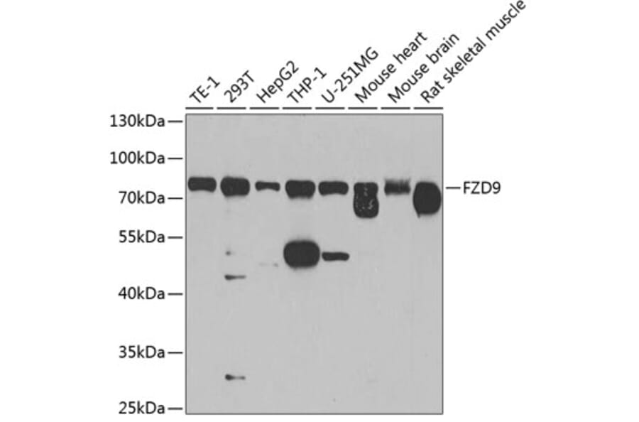 Western Blot - Anti-Frizzled 9 Antibody (A16154) - Antibodies.com