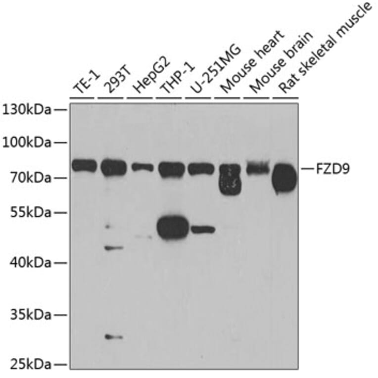 Western Blot - Anti-Frizzled 9 Antibody (A16154) - Antibodies.com