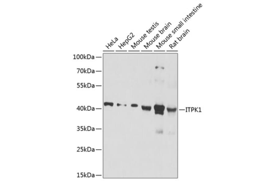 Western Blot - Anti-ITPK1 Antibody (A16155) - Antibodies.com