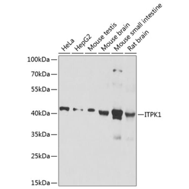 Western Blot - Anti-ITPK1 Antibody (A16155) - Antibodies.com