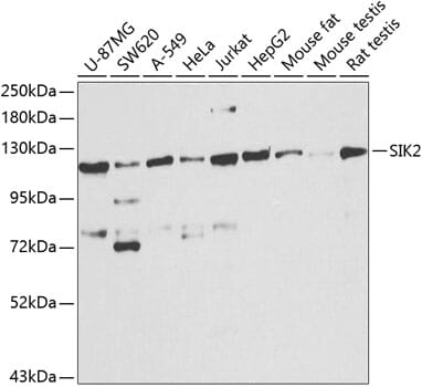 Western blot analysis of extracts of various cell lines, using Anti-SIK2 Antibody (A8321) at 1:1,000 dilution.
Secondary antibody: Goat Anti-Rabbit IgG (H+L) (HRP) (AS014) at 1:10,000 dilution.
Lysates / proteins: 25µg per lane.
Blocking buffer: 3% non-fat dry milk in TBST.
Detection: ECL Basic Kit (RM00020).
Exposure time: 30s.