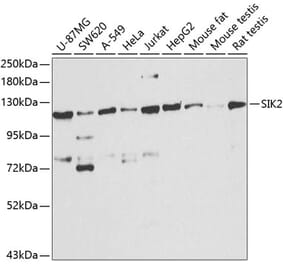 Western Blot - Anti-SIK2 Antibody (A16156) - Antibodies.com
