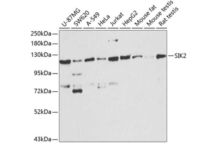 Western Blot - Anti-SIK2 Antibody (A16156) - Antibodies.com