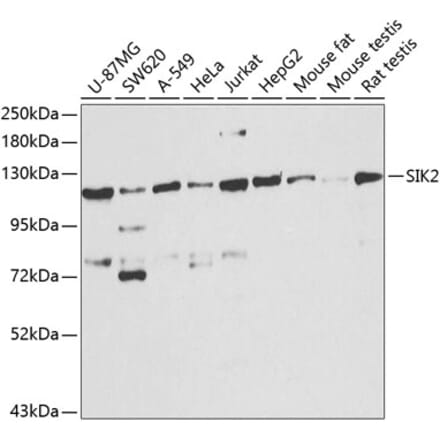 Western Blot - Anti-SIK2 Antibody (A16156) - Antibodies.com