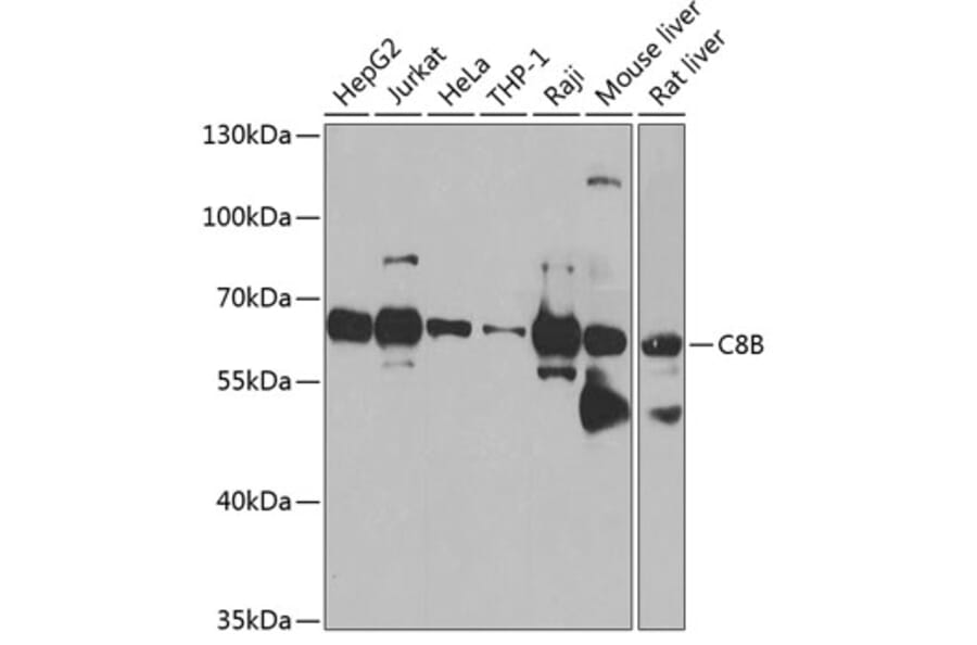 Western Blot - Anti-Complement factor 8 beta/C8B Antibody (A16157) - Antibodies.com