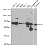 Western Blot - Anti-Complement factor 8 beta/C8B Antibody (A16157) - Antibodies.com