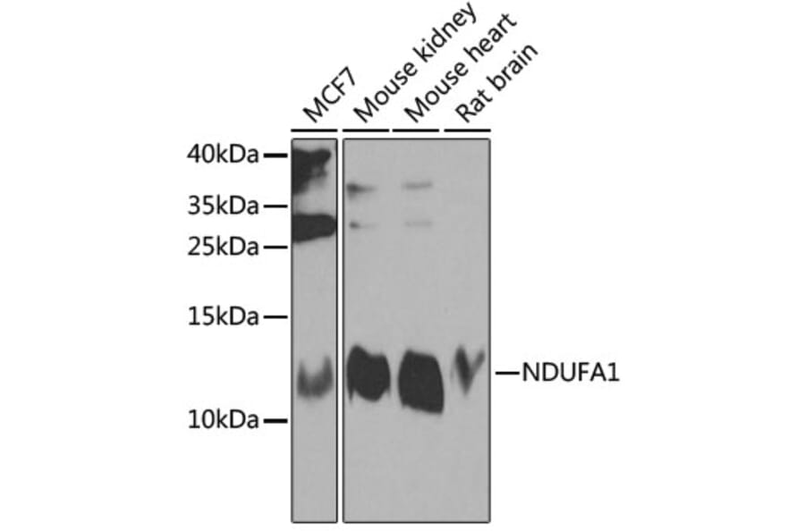 Western Blot - Anti-NDUFA1 Antibody (A16158) - Antibodies.com