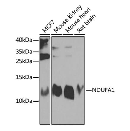 Western Blot - Anti-NDUFA1 Antibody (A16158) - Antibodies.com