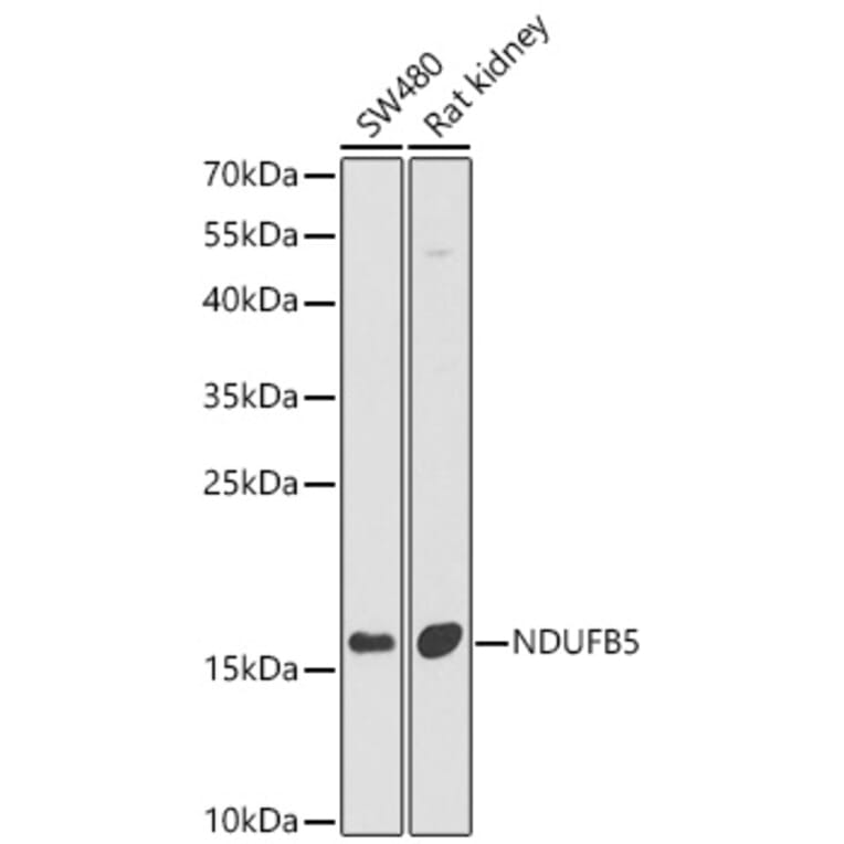 Western Blot - Anti-NDUFB5 Antibody (A16159) - Antibodies.com