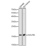 Western Blot - Anti-NDUFB5 Antibody (A16159) - Antibodies.com