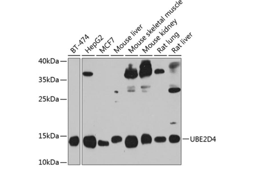 Western Blot - Anti-UBE2D4 Antibody (A16160) - Antibodies.com