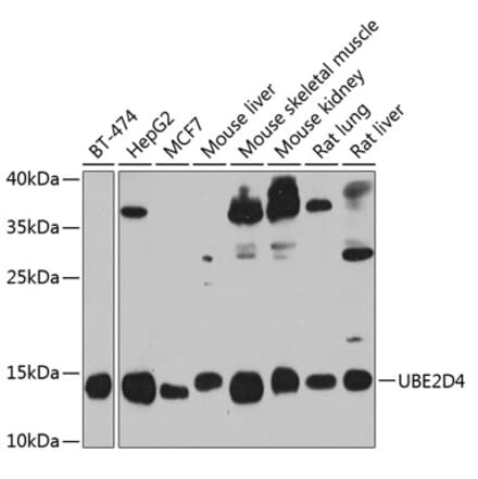 Western Blot - Anti-UBE2D4 Antibody (A16160) - Antibodies.com