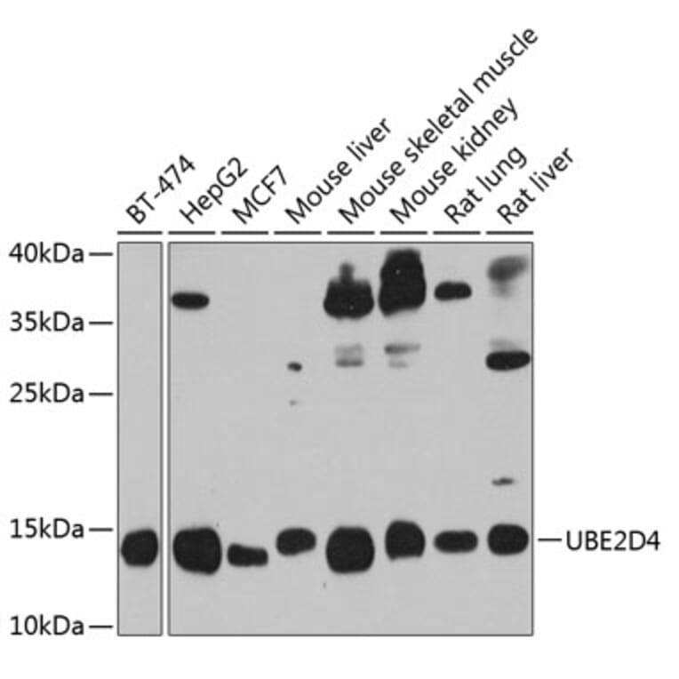 Western Blot - Anti-UBE2D4 Antibody (A16160) - Antibodies.com