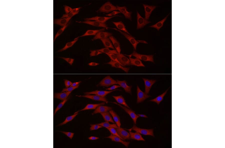 Immunofluorescence - Anti-cGAS Antibody (A16161) - Antibodies.com