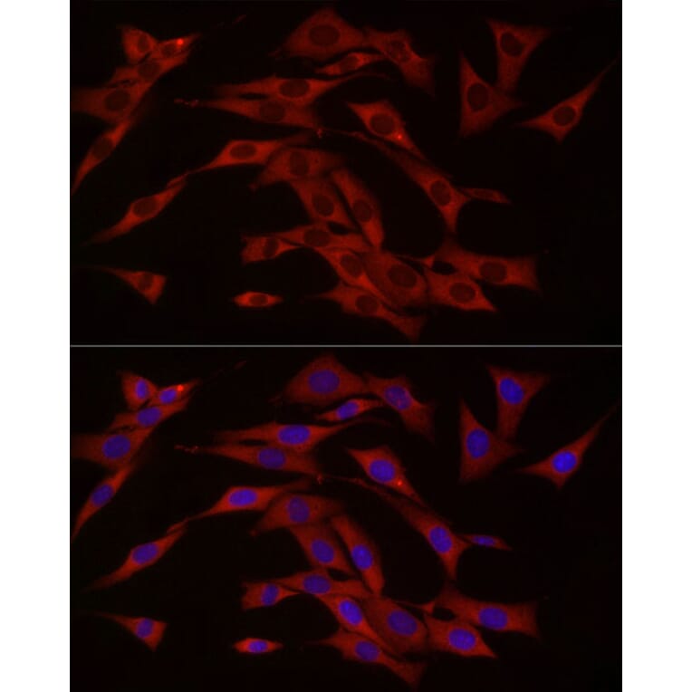 Immunofluorescence - Anti-cGAS Antibody (A16161) - Antibodies.com