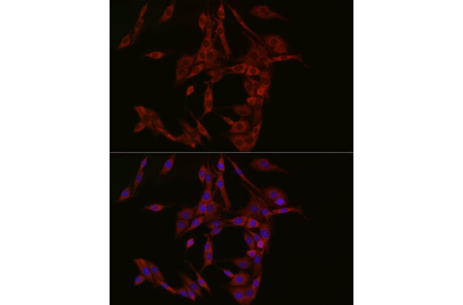 Immunofluorescence - Anti-cGAS Antibody (A16161) - Antibodies.com