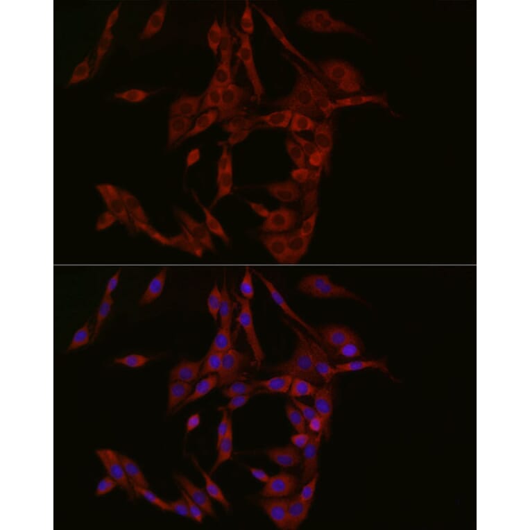 Immunofluorescence - Anti-cGAS Antibody (A16161) - Antibodies.com