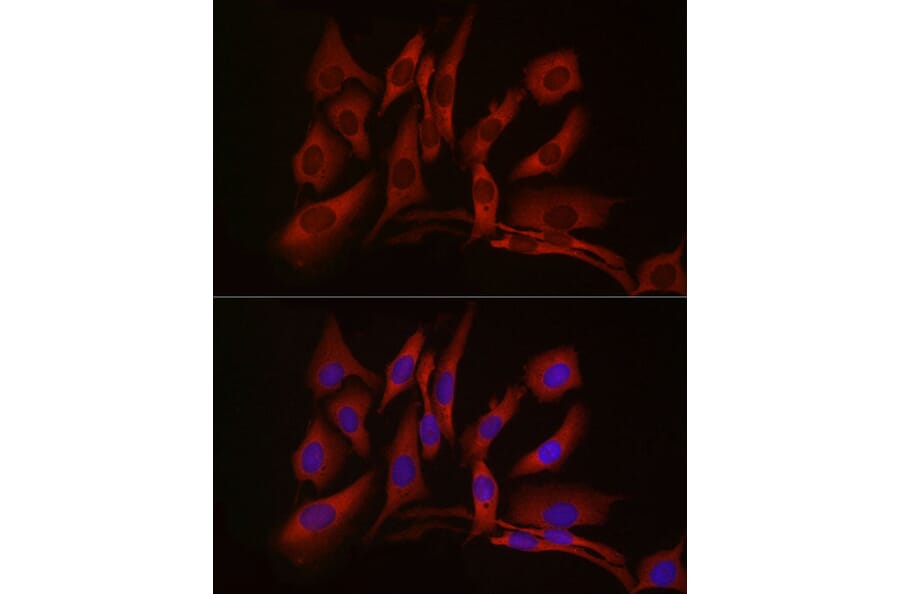 Immunofluorescence - Anti-cGAS Antibody (A16161) - Antibodies.com