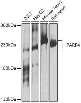 Western blot analysis of extracts of various cell lines, using Anti-PARP4 Antibody (A8343) at 1:1,000 dilution.
Secondary antibody: Goat Anti-Rabbit IgG (H+L) (HRP) (AS014) at 1:10,000 dilution.
Lysates / proteins: 25µg per lane.
Blocking buffer: 3% non-fat dry milk in TBST.
Detection: ECL Basic Kit (RM00020).
Exposure time: 5s.