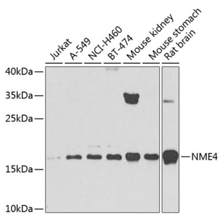 Western Blot - Anti-NME4 Antibody (A16163) - Antibodies.com