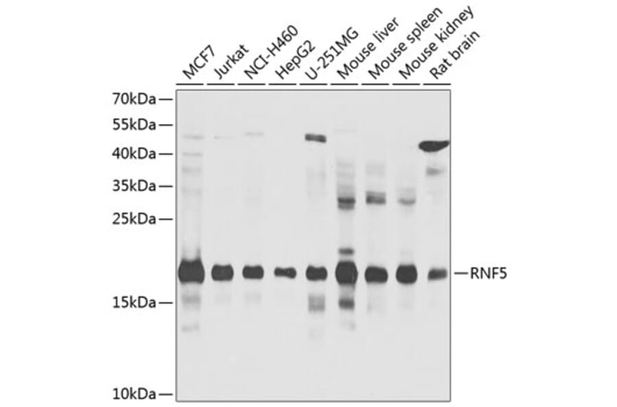Western Blot - Anti-RNF5/NG2 Antibody (A16164) - Antibodies.com