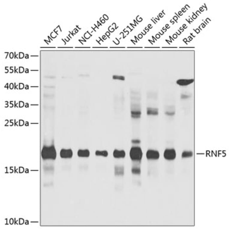 Western Blot - Anti-RNF5/NG2 Antibody (A16164) - Antibodies.com