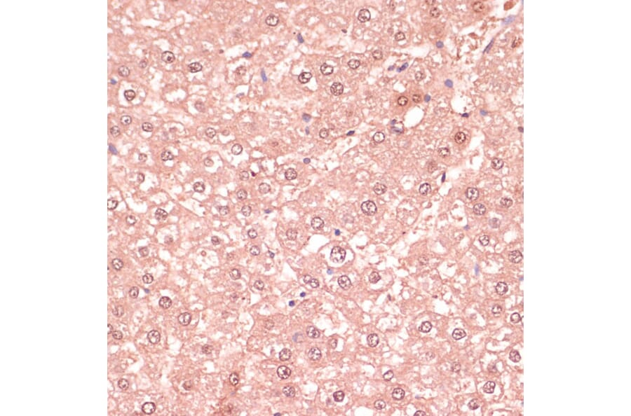 Immunohistochemistry - Anti-RNF5/NG2 Antibody (A16164) - Antibodies.com