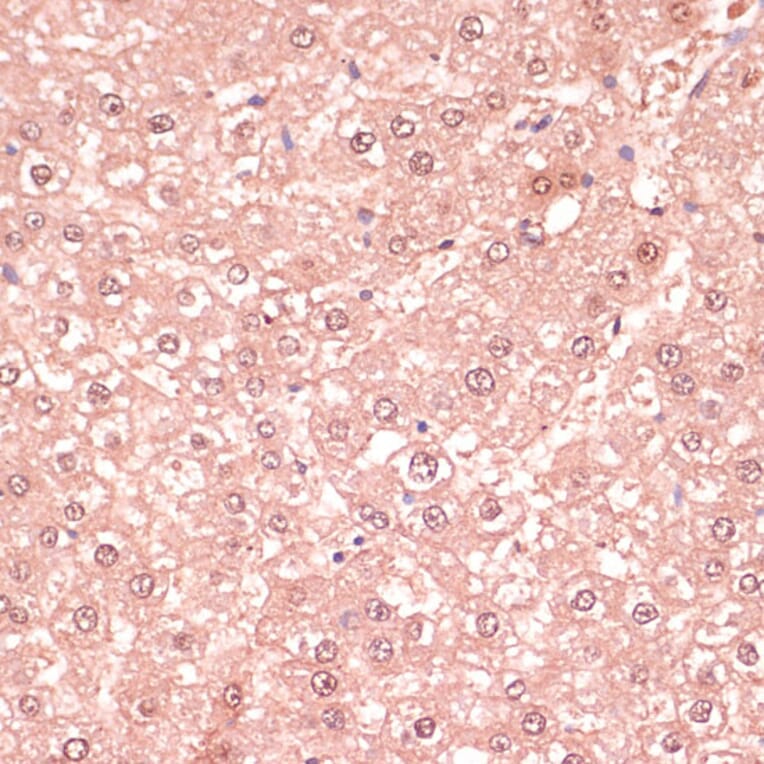 Immunohistochemistry - Anti-RNF5/NG2 Antibody (A16164) - Antibodies.com