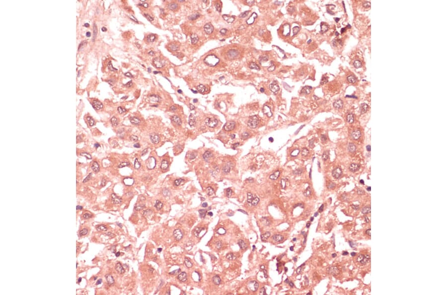 Immunohistochemistry - Anti-RNF5/NG2 Antibody (A16164) - Antibodies.com