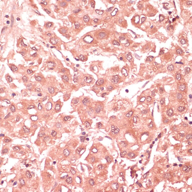 Immunohistochemistry - Anti-RNF5/NG2 Antibody (A16164) - Antibodies.com