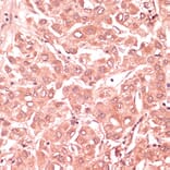 Immunohistochemistry - Anti-RNF5/NG2 Antibody (A16164) - Antibodies.com