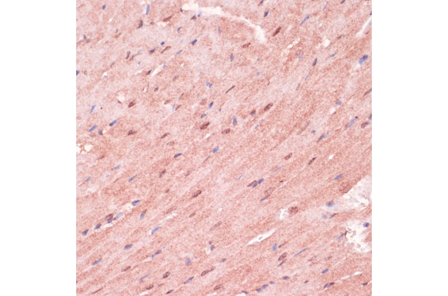 Immunohistochemistry - Anti-RNF5/NG2 Antibody (A16164) - Antibodies.com