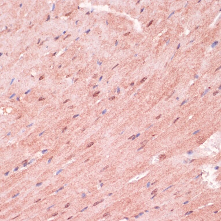 Immunohistochemistry - Anti-RNF5/NG2 Antibody (A16164) - Antibodies.com