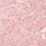 Immunohistochemistry - Anti-RNF5/NG2 Antibody (A16164) - Antibodies.com