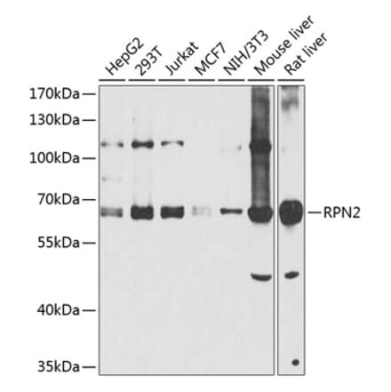 Western Blot - Anti-RPN2 Antibody (A16165) - Antibodies.com