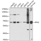 Western Blot - Anti-RPN2 Antibody (A16165) - Antibodies.com